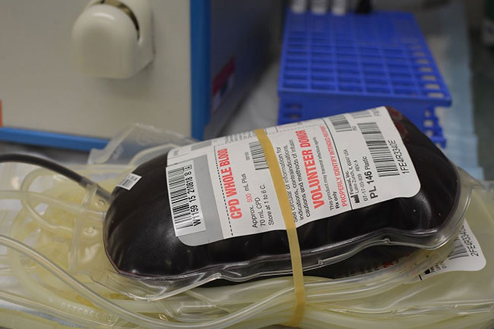 Paying for transport to get out equipment and disability